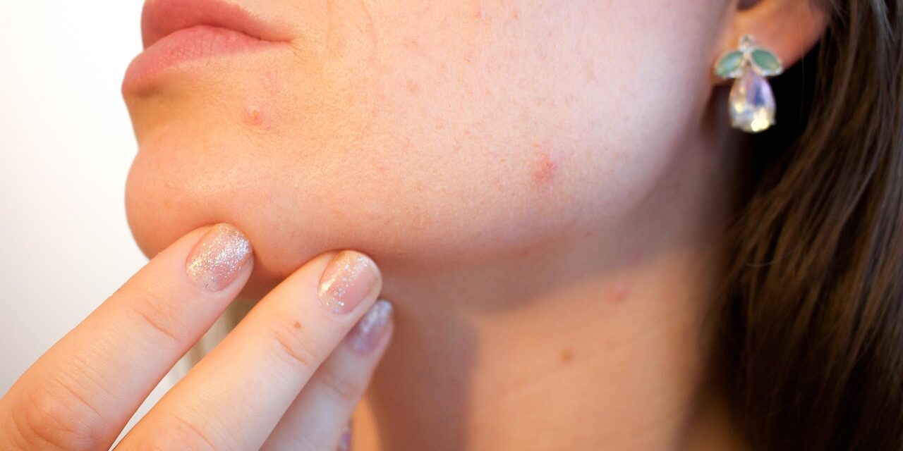 Beyond the surface: custom skincare for chronic skin challenges