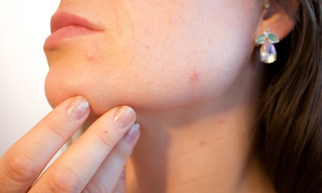 Beyond the surface: custom skincare for chronic skin challenges