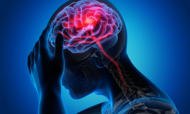 Photo by u_if8o5n0ioo Migraine photo
